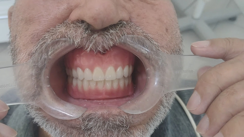 Foto 2 de ImplanVita Odontologia