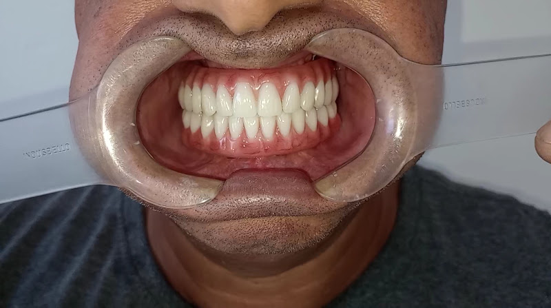 Foto 3 de ImplanVita Odontologia