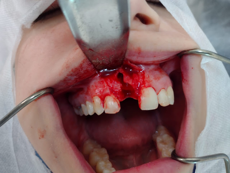 Foto 3 de ImplaOrtos Estetica Dental