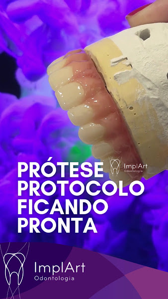 Foto 3 de ImplArt Odontologia Implante Dentario