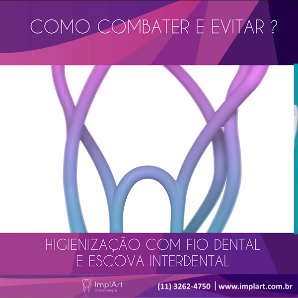 Foto 5 de ImplArt Odontologia Implante Dentario