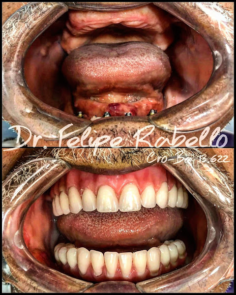 Foto 3 de ImPro Odontologia Especializada