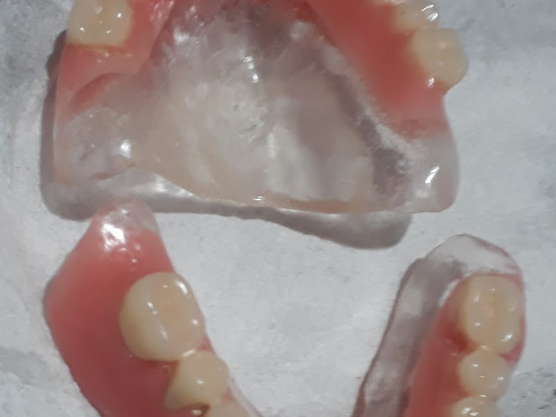 Foto 3 de inacio protetico