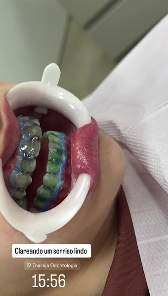 Foto 3 de Inareja Odontologia