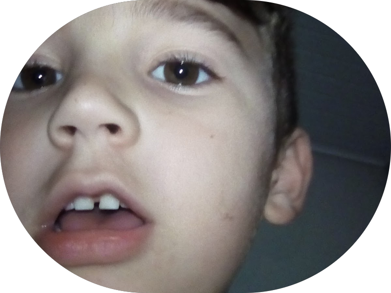 Foto 5 de Incluir Odontologia Humanizada - Odontologia para Autistas