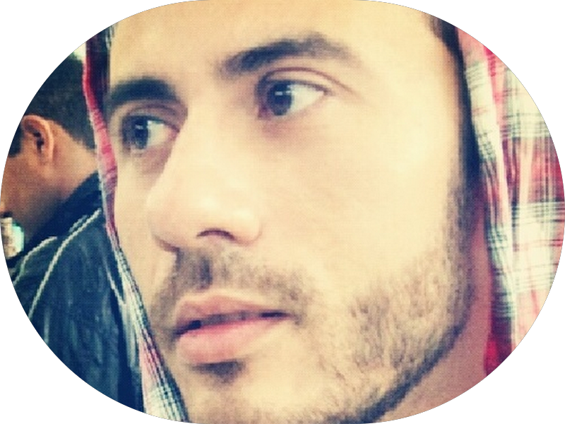 Foto 6 de Infinite Odontologia Integrada | Bruxismo - SouSmile - Implante Dentário em Niterói