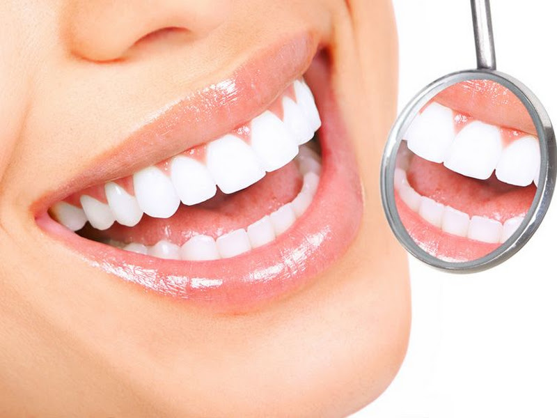 Foto 10 de Infinite Odontologia Integrada | Bruxismo - SouSmile - Implante Dentário em Niterói