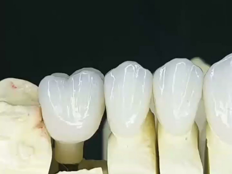 Foto 2 de InLine Protese Odontologica