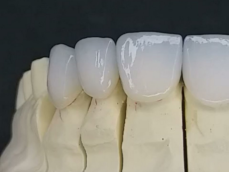 Foto 3 de InLine Protese Odontologica