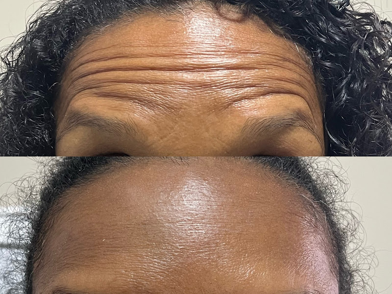 Foto de Innover Harmonização Facial | Botox no Centro de Niterói