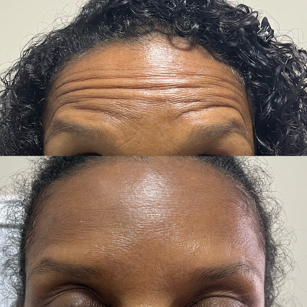 Foto 2 de Innover Harmonização Facial | Botox no Centro de Niterói