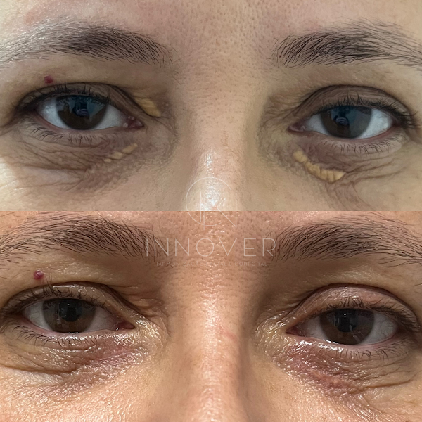 Foto 3 de Innover Harmonização Facial | Botox no Centro de Niterói