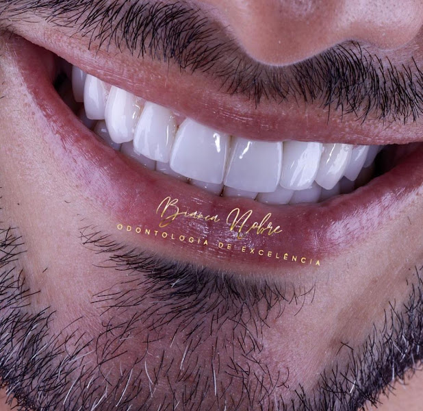 Foto 3 de INO Premium