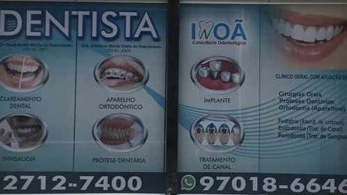 Foto 2 de Inoã Consutório Odontológico ( Dr. Paulo André Rocha do Nascimento)