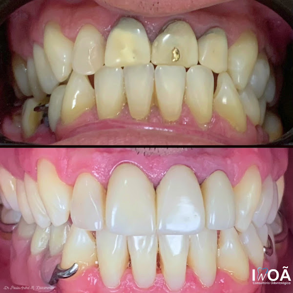 Foto 3 de Inoã Consutório Odontológico ( Dr. Paulo André Rocha do Nascimento)