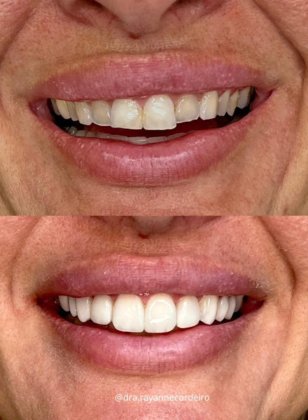 Foto 2 de INOA Odontologia | Dentista em Maceió