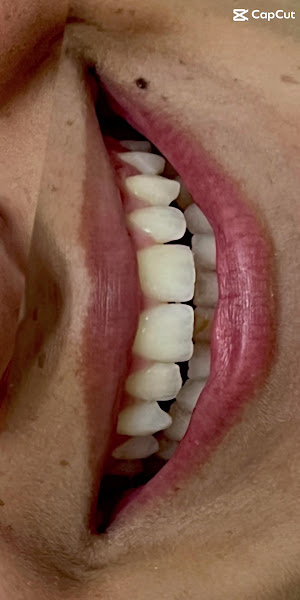 Foto 3 de INOA Odontologia | Dentista em Maceió