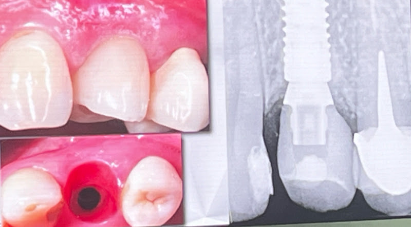 Foto 2 de INORR ODONTOLOGIA