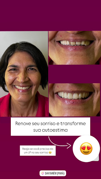 Foto 3 de Inova Odonto Santarenzinho - Dentista