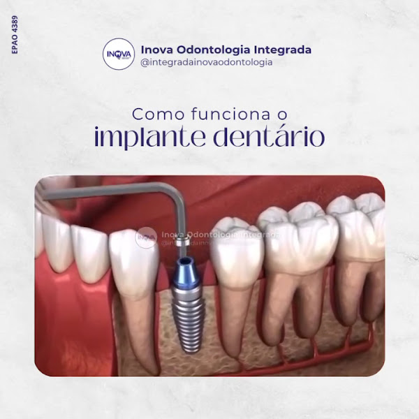 Foto 2 de Inova Odontologia Integrada