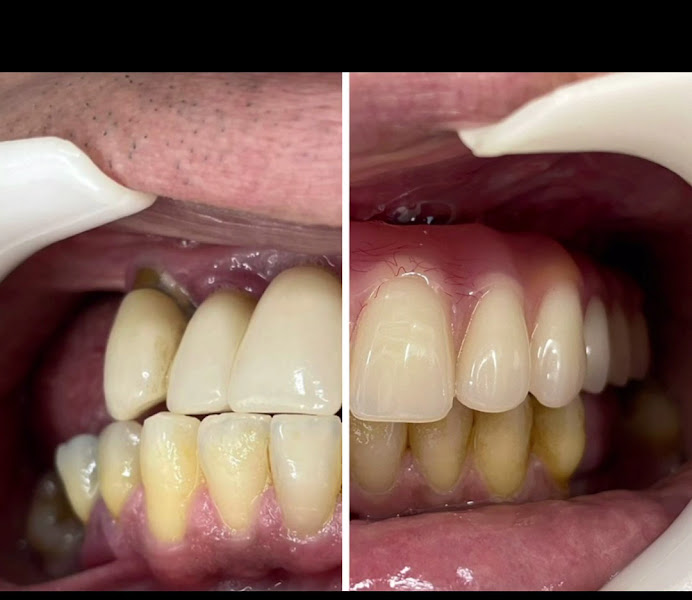 Foto 3 de Inova Premier - Clínica Odontológica - Implantes em até 24H