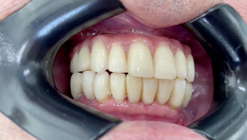 Foto 4 de Inova Premier - Clínica Odontológica - Implantes em até 24H