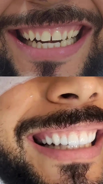 Foto 3 de Inovaprime Odonto Consultório Odontológico