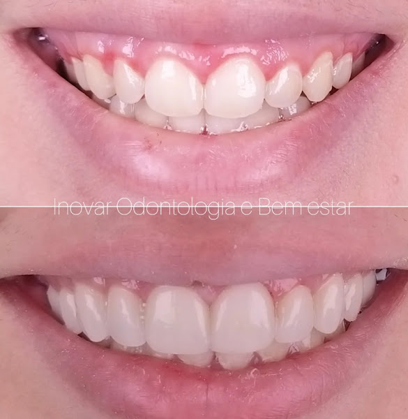 Foto 3 de Inovar Odontologia e Bem-Estar.