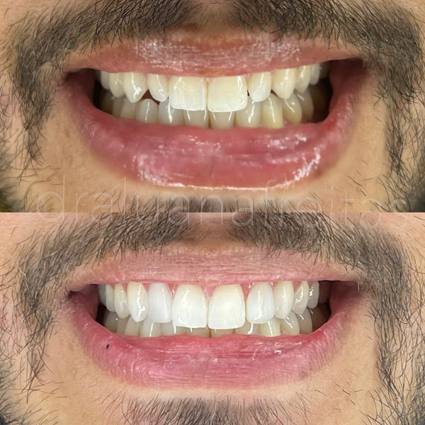 Foto 2 de Inovar Odontologia e Saúde