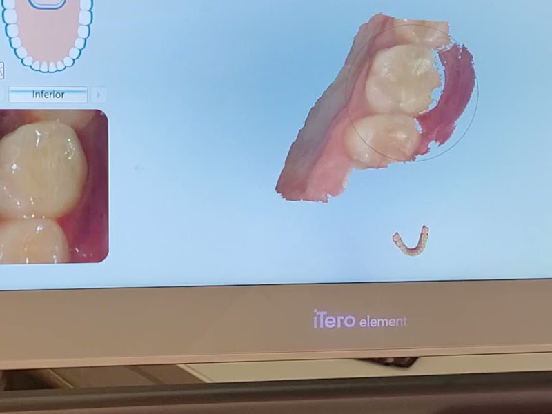 Foto 3 de Inovar Odontologia Especializada | Implante Dentário e Ortodontia em Niterói