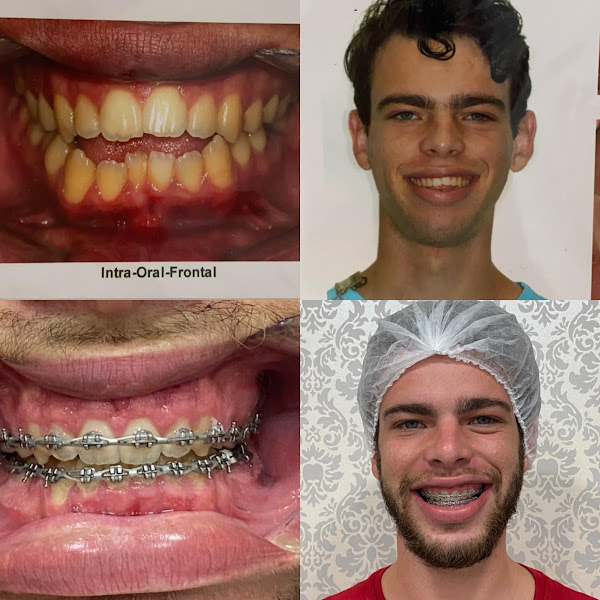 Foto 2 de Inovare Odontologia- DENTISTA RIO DAS OSTRAS