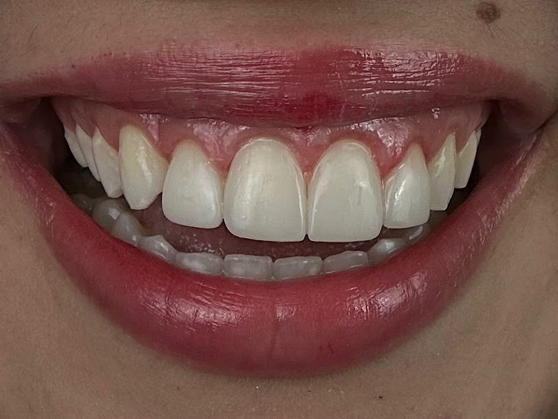 Foto 7 de Inovati Care Odontologia