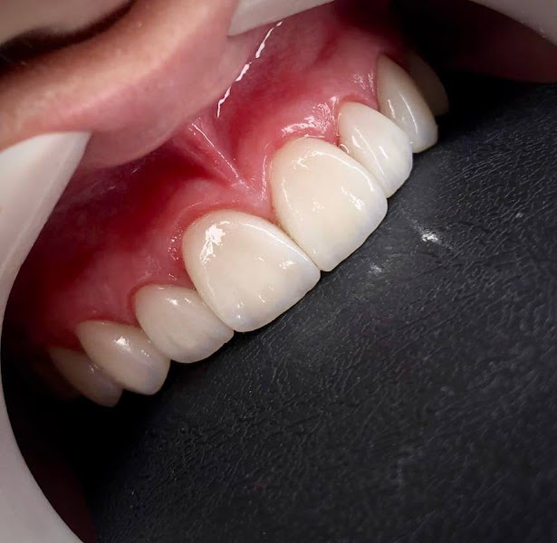 Foto 2 de Inove odontologia