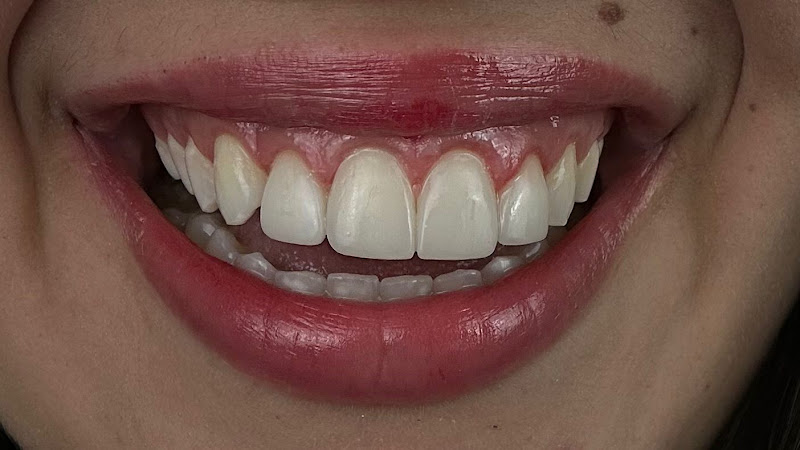 Foto 2 de Inove Odontologia e Saúde