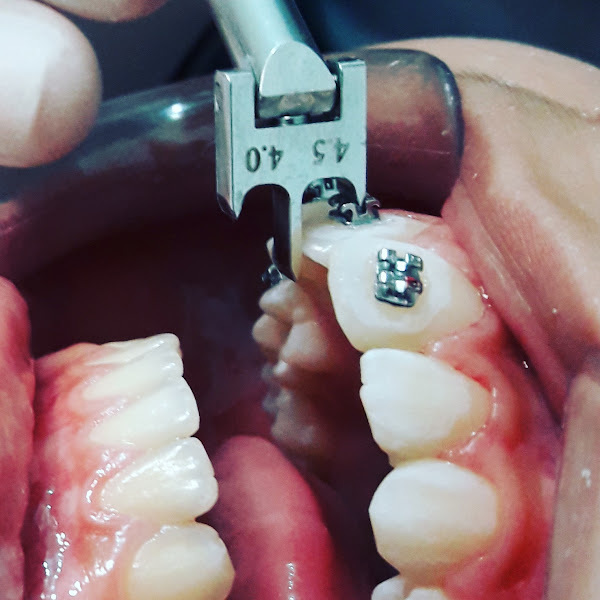 Foto 3 de Inoveodonto