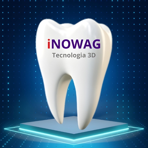 Foto 2 de iNOWAG