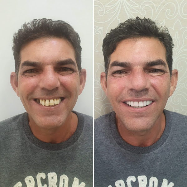 Foto 2 de Insigne Odontologia Bela Vista