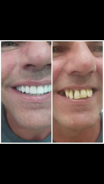 Foto 4 de Insigne Odontologia Bela Vista