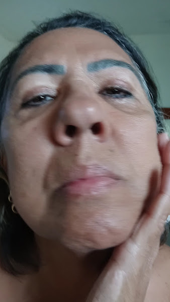 Foto 4 de Instituto Andrea Tedesco - Harmonização Facial