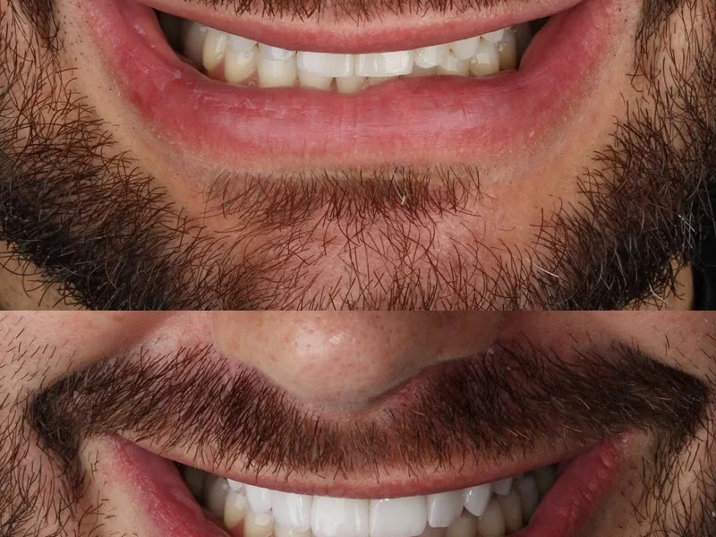 Foto de Instituto Arthur Tibúrcio - Lentes e Implantes