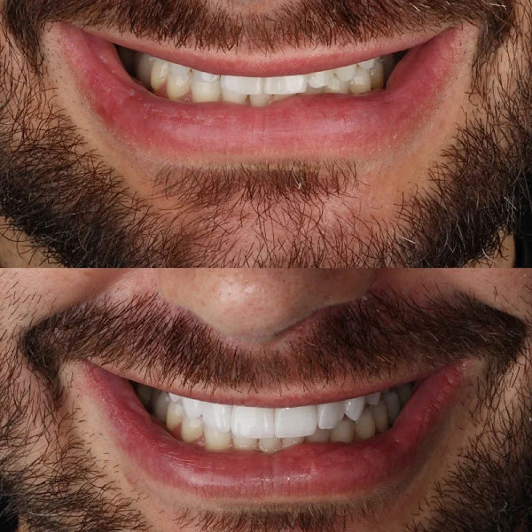 Foto 2 de Instituto Arthur Tibúrcio - Lentes e Implantes