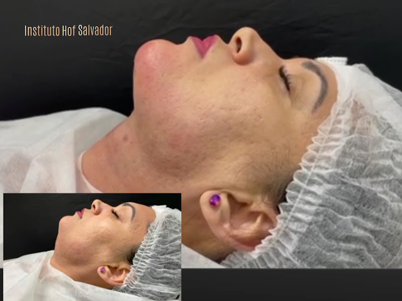 Foto 3 de Instituto Bahia Face