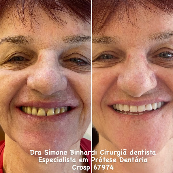 Foto 2 de Instituto Binhardi Odontologia São José Do Rio Preto – Dentista, Implantes, Próteses Dentárias, Facetas e Reabilitação Oral