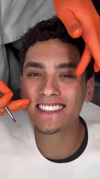 Foto 3 de Instituto Breno Rodrigues - Lentes de contato dental Recife