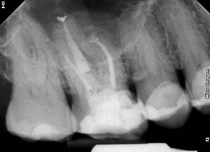Foto 3 de Instituto Brunini - Endodontia e Psicologia
