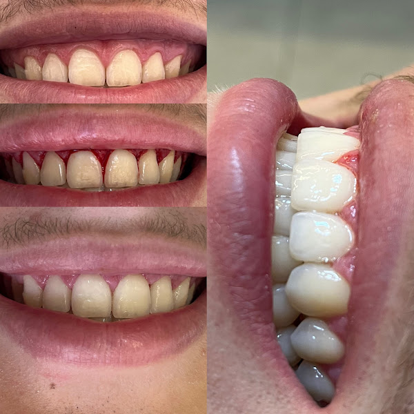 Foto 2 de Instituto Bruxelas Odontologia