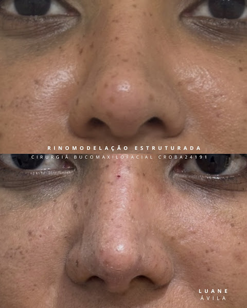 Foto 2 de Instituto Bucomaxilo - Lip lift e Rinomodelação definitiva em Salvador