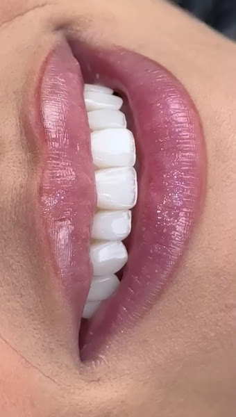 Foto 3 de Instituto Camilla Masgrau - Odontologia Estética