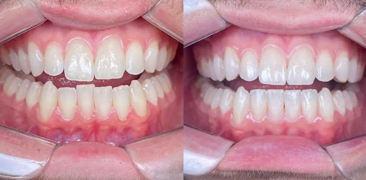 Foto 3 de Instituto Candido Odontologia Integrada