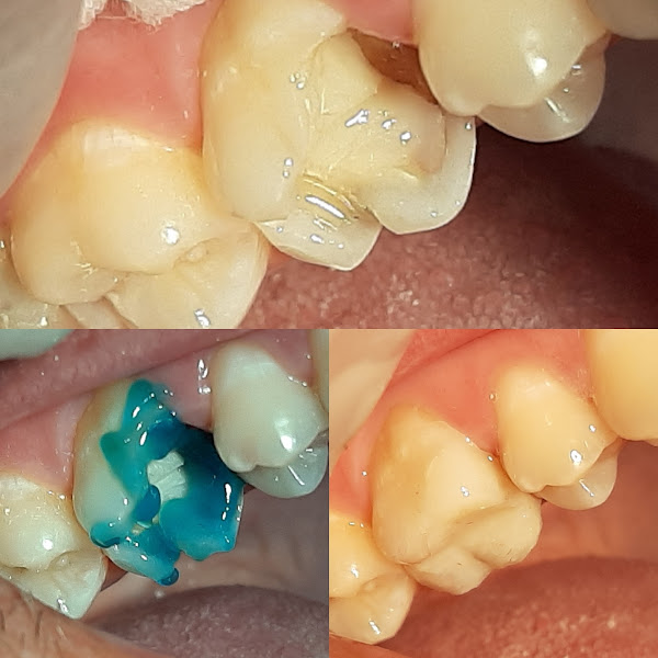 Foto 2 de Instituto Damião Odonto/Implantes/Harmonização Facial/Invisalign/Lentes de Contato- Vitória-ES